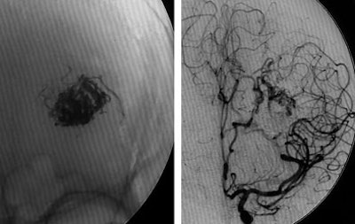 2007 04 24 13 35 11 706