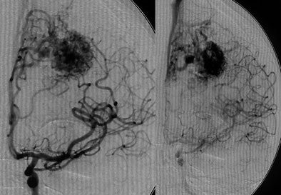 2007 04 24 13 35 49 706