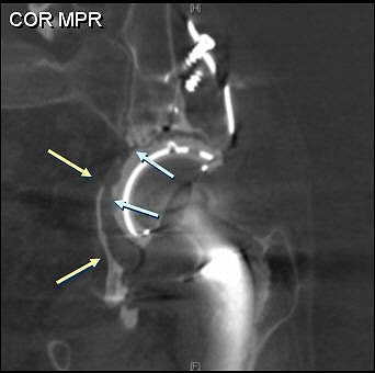 2007 04 27 16 23 30 706