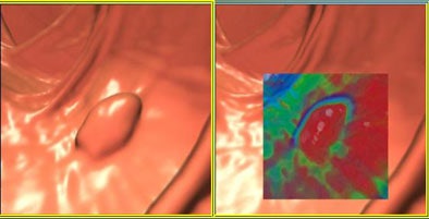 2007 05 08 14 22 19 706