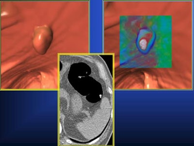 2007 05 08 14 25 13 706