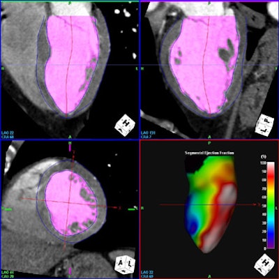 2007 05 18 14 34 05 706