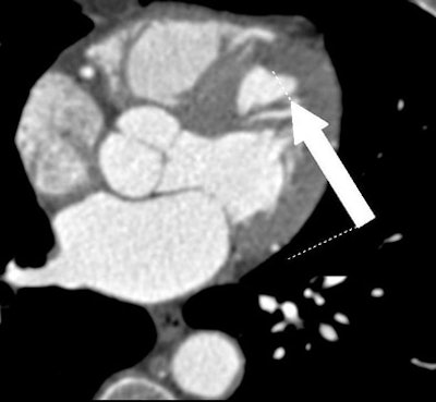 2007 05 18 14 34 37 706