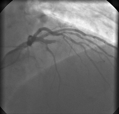 2007 05 18 14 35 02 706