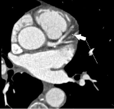 2007 05 18 14 38 25 706