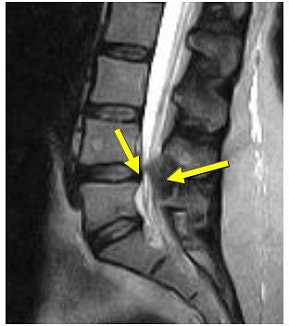 2007 05 25 12 26 32 706