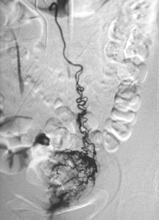 2007 05 31 15 33 53 706