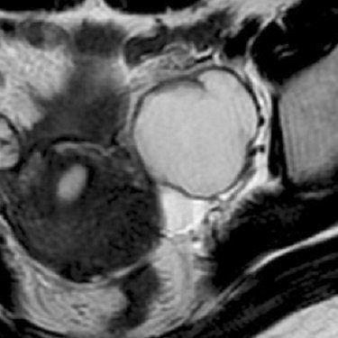 2007 06 01 14 04 45 706