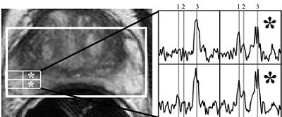 2007 06 06 14 49 22 706