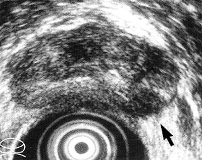 2007 06 06 14 49 52 706