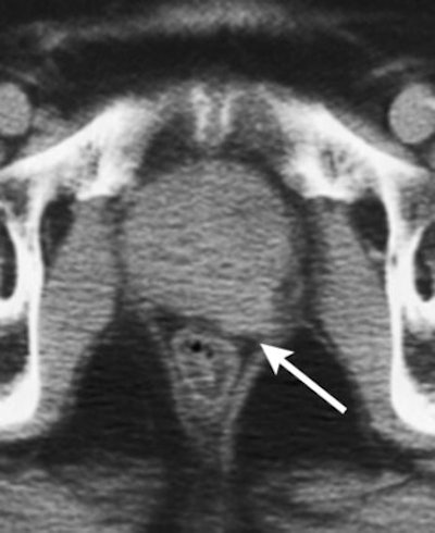 2007 06 06 14 50 04 706