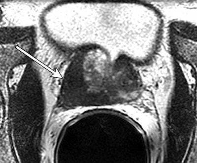 2007 06 06 14 50 16 706