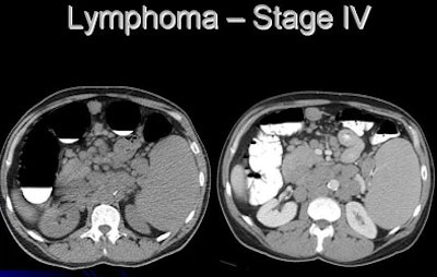 2007 06 11 14 13 28 706