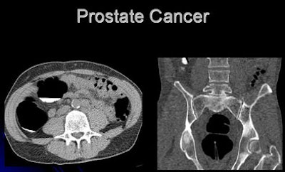 2007 06 11 14 13 42 706