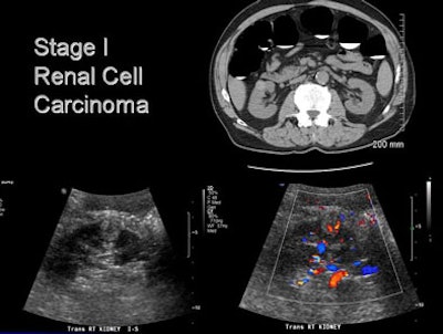 2007 06 11 14 14 09 706