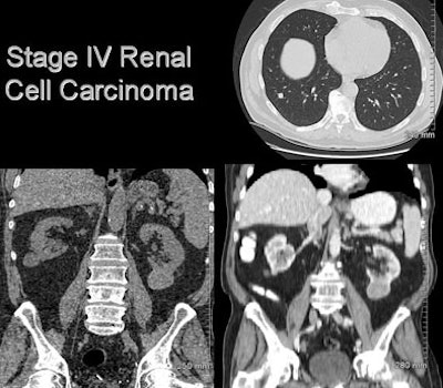 2007 06 11 14 14 23 706