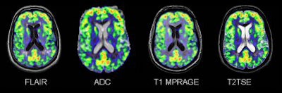 2007 06 11 15 43 10 706