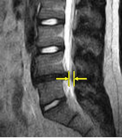 2007 06 15 14 03 35 706