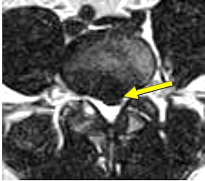 2007 06 15 14 03 50 706