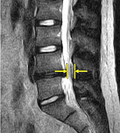 2007 06 15 14 04 06 706