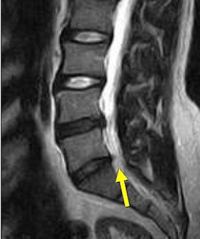 2007 06 15 14 04 36 706