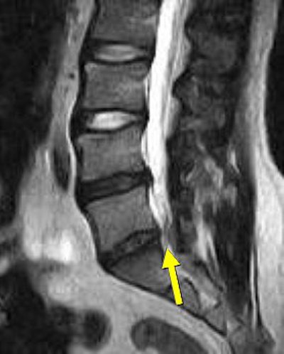 2007 06 15 14 04 48 706