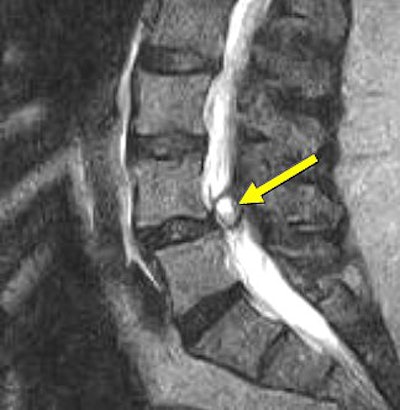 2007 06 15 14 05 29 706