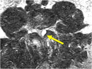 2007 06 15 14 05 39 706