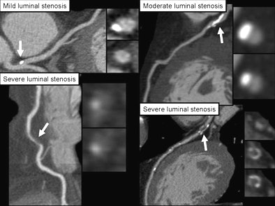 2007 06 18 21 49 19 706