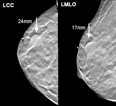 2007 06 20 16 08 23 706