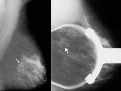 2007 06 20 16 23 40 706