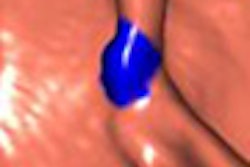 2007 06 29 16 24 07 706