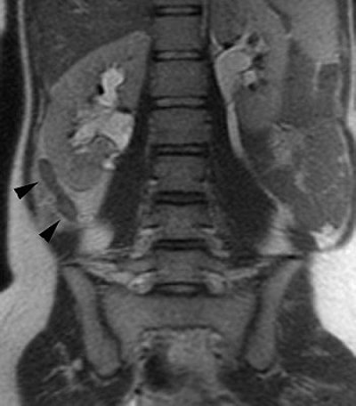 2007 07 02 14 25 39 706