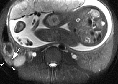 2007 07 02 14 25 57 706