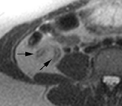 2007 07 02 14 26 13 706