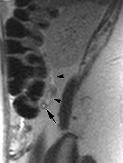 2007 07 02 14 26 29 706