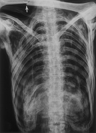 2007 07 03 15 49 31 706