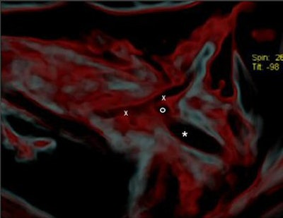 2007 07 03 15 50 00 706