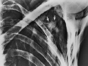 2007 07 03 15 53 37 706