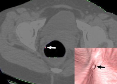 2007 07 06 14 32 38 706