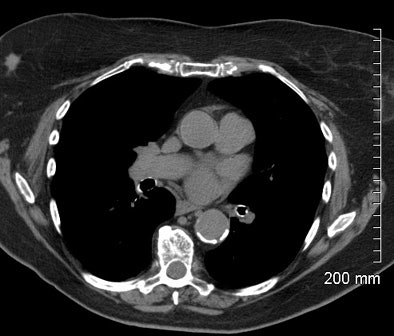 2007 07 10 14 35 47 706