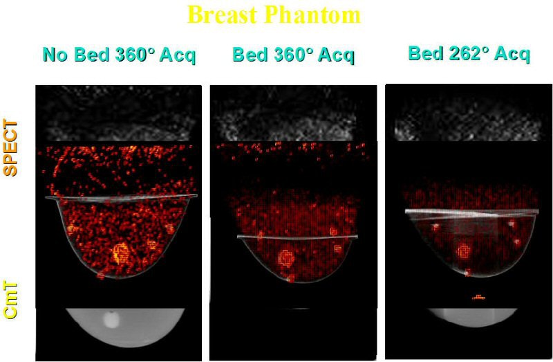 Duke MMIL designs novel SPECT/CT system for 3D breast imaging | AuntMinnie