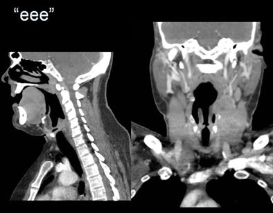 2007 07 17 15 54 27 706