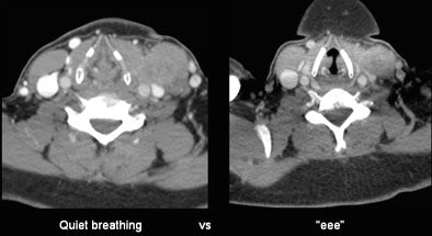 2007 07 17 15 54 41 706