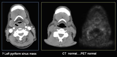 2007 07 17 15 55 08 706