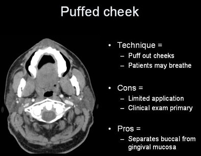 2007 07 17 15 55 23 706