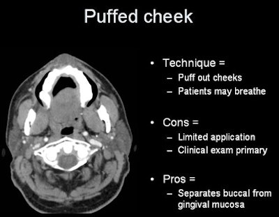 2007 07 17 15 55 23 706