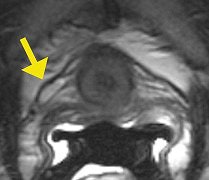 2007 07 20 14 45 28 706