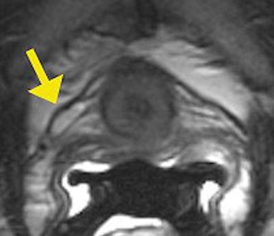 2007 07 20 14 45 28 706