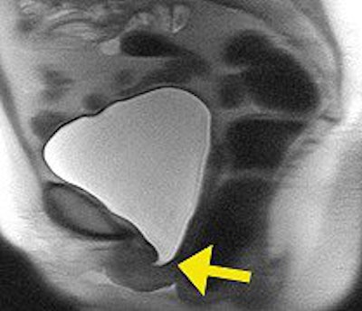 2007 07 20 14 45 56 706